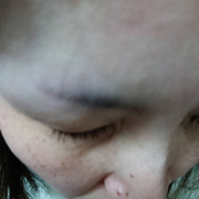 「毛穴」「シワ改善」無添加【薬用】オールインワンゲル☆ビフォーアフター投稿モニター30名様　募集！の投稿画像