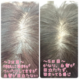 「使用前～１日目～３日目～５日目～それ以降」の画像（2枚目）