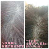 「使用前～１日目～３日目～５日目～それ以降」の画像（1枚目）