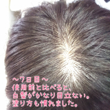 「使用前～１日目～３日目～５日目～それ以降」の画像（3枚目）