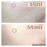 シュワトレーゼ薬用美白美容ゲル