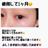 目元の小ジワに悩んでいます！本気で3ヶ月試します♡