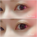 &hearts;&hearts;&hearts;...度ありカラコン フラワーアイズR全13色ありこちらはロータスブラック‪‪🖤ブラック＆14.5mmなんてかなり久しぶりにつけましたがやっぱり裸眼との差がすごい&hellip;のInstagram画像