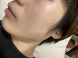 シミ