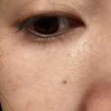 開いた毛穴にくすみ