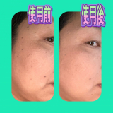 手のエイジング