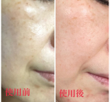 塗って剥がすだけの簡単シミケア！