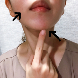 くすみ、ニキビがさっぱり♪