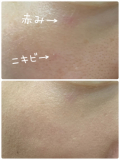 「カバー力は勿論、キープ力もすごい。」の画像（2枚目）
