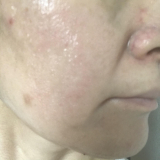 「自然な仕上がり」の画像（1枚目）