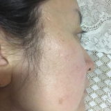 「自然な仕上がり」の画像（2枚目）