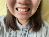簡単に歯が綺麗になりました