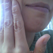 「ほほのたるみとほうれいせんに毛穴」＼モニター満足度97％／「シワ改善」無添加【薬用】オールインワンゲル☆ビフォーアフター投稿モニター30名様　募集！の投稿画像