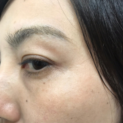 「目の下のシワ　2021/10/13撮影日」＼モニター満足度97％／「シワ改善」無添加【薬用】オールインワンゲル☆ビフォーアフター投稿モニター30名様　募集！の投稿画像