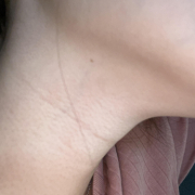 「首元のたるみ、シワ」＼モニター満足度97％／「シワ改善」無添加【薬用】オールインワンゲル☆ビフォーアフター投稿モニター30名様　募集！の投稿画像