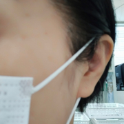 「目の横・・・」＼モニター満足度97％／「シワ改善」無添加【薬用】オールインワンゲル☆ビフォーアフター投稿モニター30名様　募集！の投稿画像