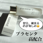 🍀【プラセンタ高配合コスパ良し化粧水②】株式会社スターネットさん　@kenkosakasプラセンティアローション経過報告です。ここ1週間で急激に空気の乾燥が激しくなって&hellip;のInstagram画像