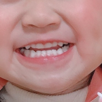 #ホワイトクラブ　💗 #スパークリングイレーサー #ホワイトニング #白い歯 #セルフホワイトニング #ホワイトニングキット #ホームホワイトニング #ハンディライト #ハンディ #monip&hellip;のInstagram画像