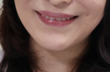 口元写真
