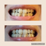 「ビフォーアフター」の画像（1枚目）