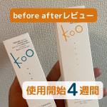 1か月間、化粧品使ってみた！総じて、やってみてよかったです。美容断食いいと思います！男女問わず、夜寝る前にこの化粧品使うことで肌トラブル改善につながるかも！感想は以下・乾燥&hellip;のInstagram画像