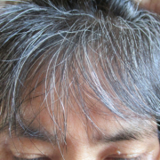 「白髪具合レポート写真」【最大10名様】白髪染め製品21日間モニター募集！の投稿画像