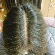 「気になります。」【最大10名様】白髪染め製品21日間モニター募集！の投稿画像