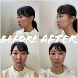 「口周りスッキリ」の画像（1枚目）