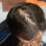 もう直ぐ52歳の旦那の頭部