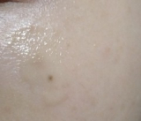 シミ、目立たなくなる