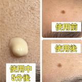 使用前後
