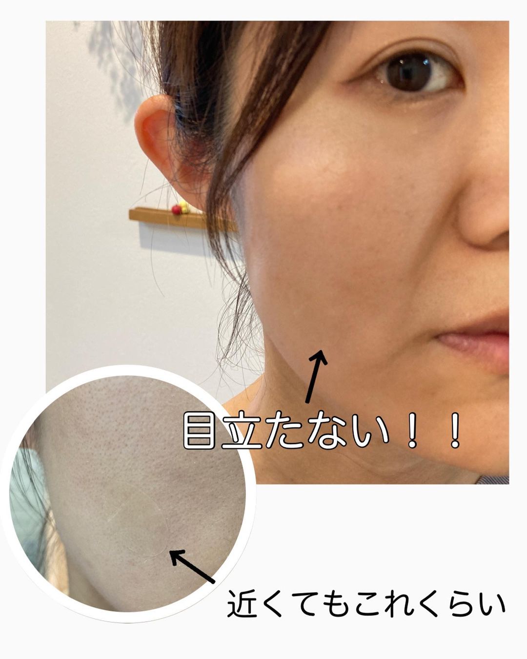 顔 絆創膏 目立た ない