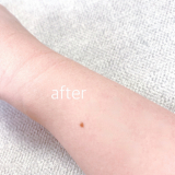 「少し薄くなった気がします。」の画像（2枚目）