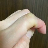 口コミ：キズクイックfit 水仕事用の画像（4枚目）