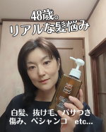 髪の悩みは尽きません😭春頃から痒みに悩まされ、頭皮が脱皮？その後、抜け毛がヤバかったです。暑くなり出した頃痒みはなくなりましたが、秋頃から生え際がカサカサに。それに加え白髪。白髪染めして&hellip;のInstagram画像
