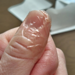 水仕事してると　どうしても指先がひどく荒れてしまって  すご〜く痛い！これでも　ケアしてるんだけどねハンドクリームや薬なども塗ってもすぐから水仕事するからなかなか完治せずバンドエイドでしみな&hellip;のInstagram画像