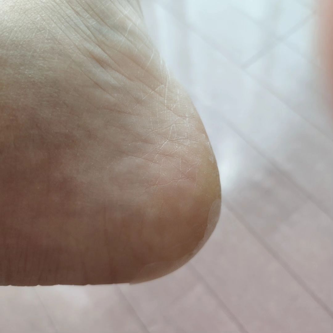 口コミ投稿：東洋化学株式会社のかかとピース✨試してみました😃透明で目立ちにくく❗かかとにピタッ…