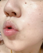 モニプラさまよりいただきました🎵モットラボリップショットです╰(*&acute;︶`*)╯♡すごい！一枚目ビフォーで、二枚目がアフターですが、プルプルピカピカに見た目はなってるデート前にプルプル&hellip;のInstagram画像