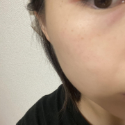 「シミやそばかすを目立たなくしてくれるコンシーラー」【発売前先行モニター♡】シミ・色むらお悩みの方！ハイドロキノン配合コンシーラー　先行モニター　の投稿画像