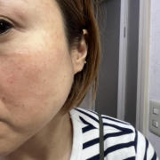 「悩み多き」【発売前先行モニター♡】シミ・色むらお悩みの方！ハイドロキノン配合コンシーラー　先行モニター　の投稿画像