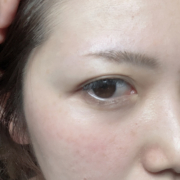 「肌悩みについて」【発売前先行モニター♡】シミ・色むらお悩みの方！ハイドロキノン配合コンシーラー　先行モニター　の投稿画像