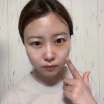 PR今回お試ししたのはマイクロニードルパック！商品名: ダーマフィラープレミア感想:鏡を見て目元に貼るだけで簡単。寝る前に貼って寝るだけなのでズボラな私でもできる。マイクロニード&hellip;のInstagram画像