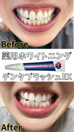 手軽だから毎日継続できる、歯の美白ケア。口元は意外とみられてます。私は歯のケアは毎日は歯磨き、デンタルフロス程度。年2回歯科検診に行ってます。コーヒーを毎日飲む習慣があるため、歯の色がくすみがち&hellip;のInstagram画像