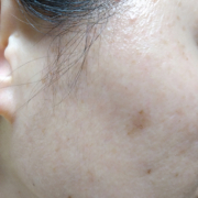 「これを薄くしたいです！」【現品モニター♡】シミ・でお悩みの方大歓迎！長期でモニターいただける方大募集♪の投稿画像