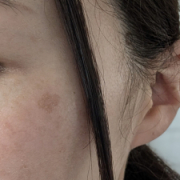 「目元のシミに悩んでいます」【現品モニター♡】シミ・でお悩みの方大歓迎！長期でモニターいただける方大募集♪の投稿画像