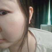 「化粧でも隠れません」【現品モニター♡】シミ・でお悩みの方大歓迎！長期でモニターいただける方大募集♪の投稿画像