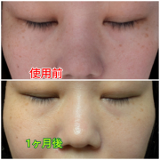 「目の下のシミ」【現品モニター♡】シミ・でお悩みの方大歓迎！長期でモニターいただける方大募集♪の投稿画像