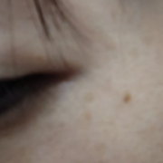 「目元のシミ」【現品モニター♡】シミ・でお悩みの方大歓迎！長期でモニターいただける方大募集♪の投稿画像