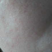 「気になる部分」シミキールナイトバームの&rdquo;発売前先行モニター&rdquo;募集♡の投稿画像