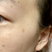 「目元のシミに悩み中」シミキールナイトバームの&rdquo;発売前先行モニター&rdquo;募集♡の投稿画像